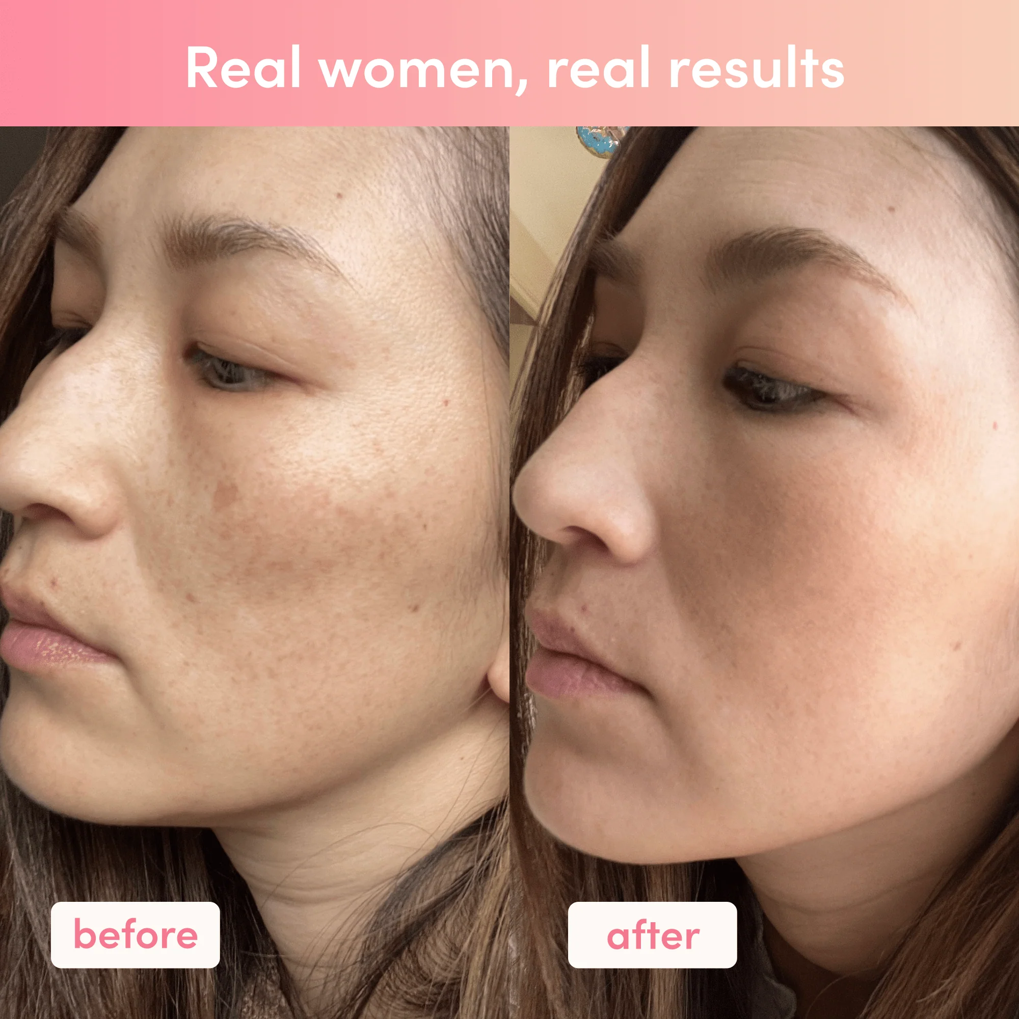 Custom Inner Beauty Bundle - Image 13