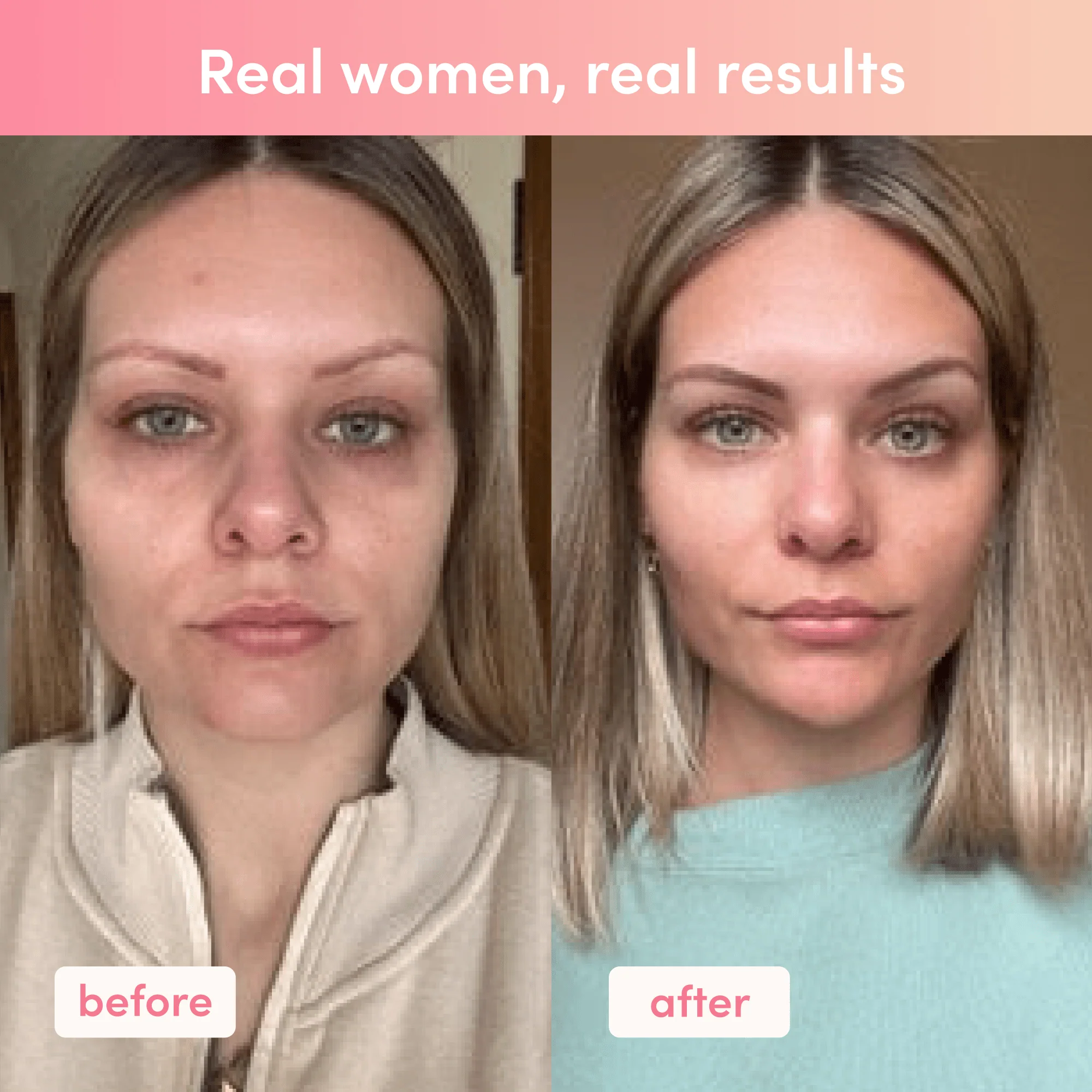 Custom Inner Beauty Bundle - Image 8