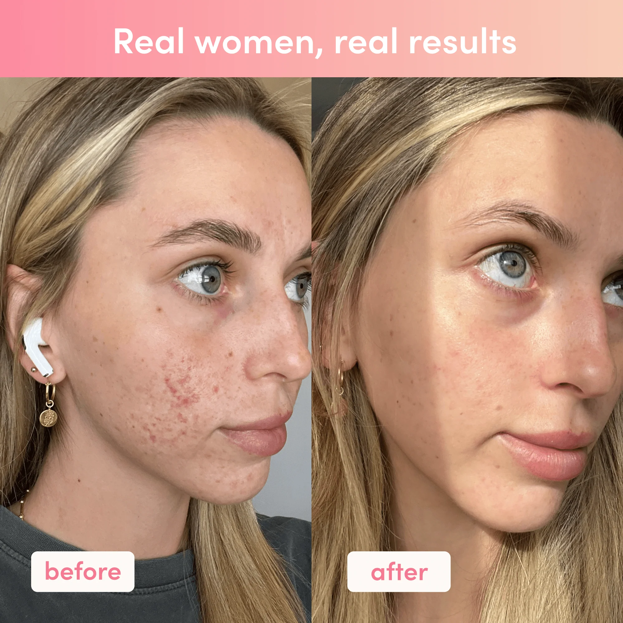 Custom Shine Bright Bundle - Image 5